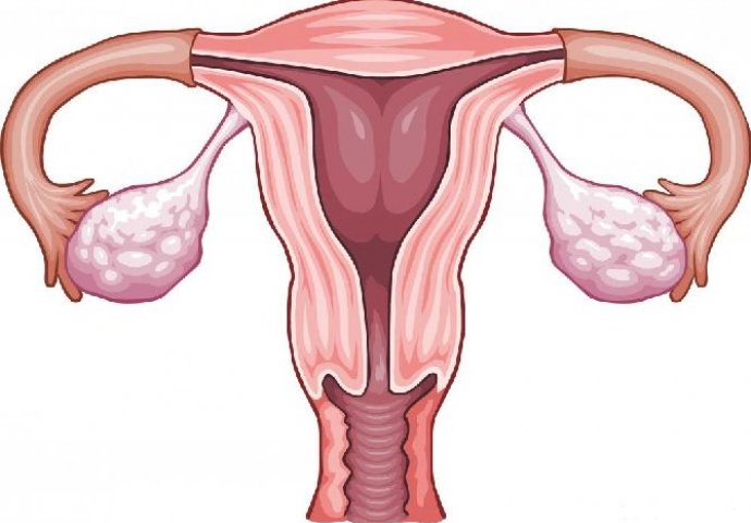 Rak jajnika: Uzroci, simptomi i liječenje