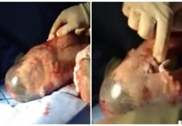 Beba rođena u netaknutom vodenjaku: Pogledajte čudesan trenutak kada je udahnula zrak (VIDEO)