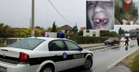 Dječak sa poteškoćama u razvoju brutalno pretučen u Mostaru 