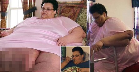 Ženi teškoj 338 kila izvadili 20 kilograma masti i sad ponovo uči hodati  