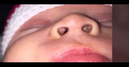 Majke budite na oprezu: Pogledajte šta je ona pronašla u bebinom nosu (VIDEO)