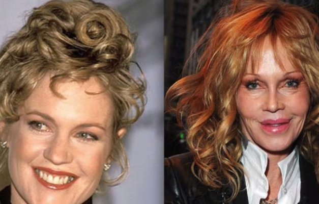 melani-grifit-operacije