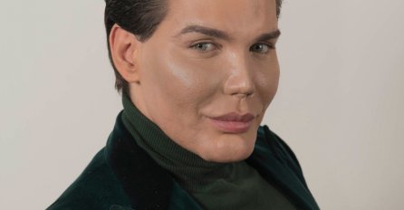 Upoznajte živog Kena: Potrošio 387.000 eura na plastične operacije kako bi izgledao kao lutka iz djetinjstva