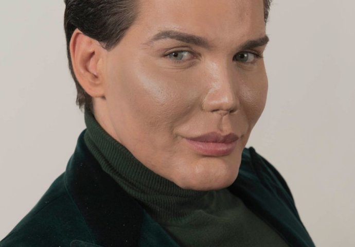 Upoznajte živog Kena: Potrošio 387.000 eura na plastične operacije kako bi izgledao kao lutka iz djetinjstva