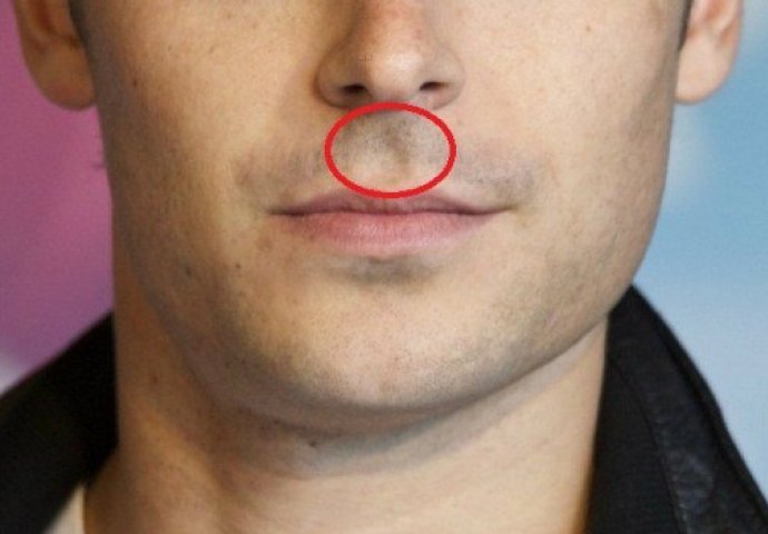 Iznenadit ćete se: Evo šta znači kada imate šupljinu između nosa i gornje usne (FOTO)