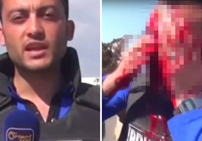 UZNEMIRUJUĆI SNIMAK: Reportera usred izvještaja pogodio geler u glavu