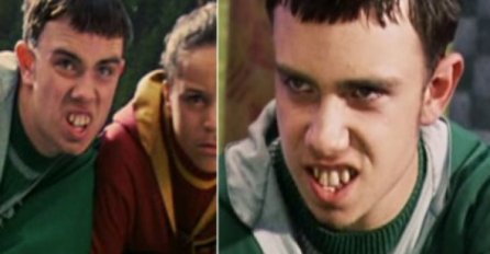 KO SE SJEĆA OVOG ZUBATOG MOMČIĆA IZ HARRY POTTERA? E, pa sada izgleda potpuno drugačije i - seksi!