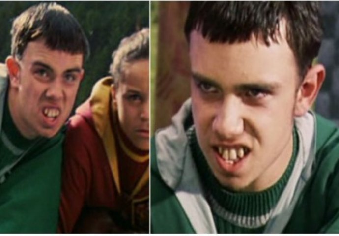KO SE SJEĆA OVOG ZUBATOG MOMČIĆA IZ HARRY POTTERA? E, pa sada izgleda potpuno drugačije i - seksi!