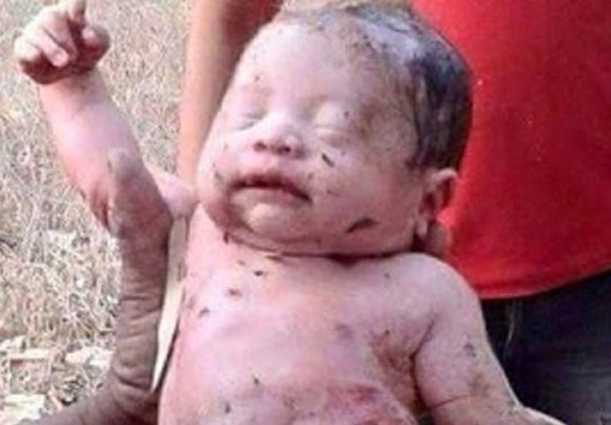 Izboli su bebu 14 puta i sahranili je živu, a danas izgleda ovako