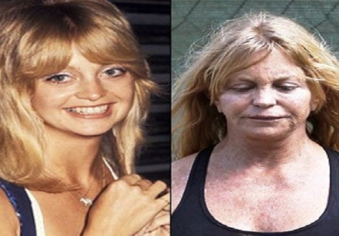  BIVŠE IKONE LJEPOTE: Evo na šta danas liče