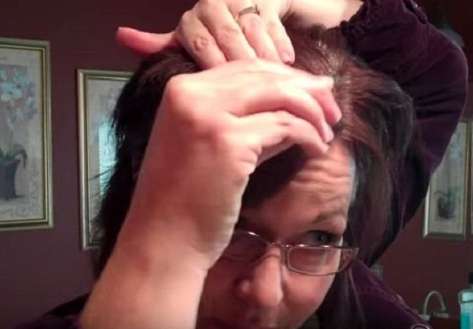 Riješite se sijede kose na prirodan način: Evo kako je to ona uradila (VIDEO)