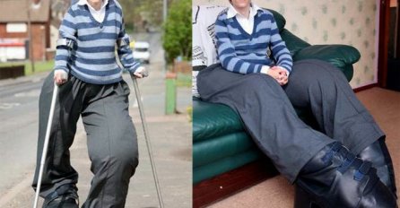 Djevojci amputirali nogu, nakon operacije noga počela ponovo rasti