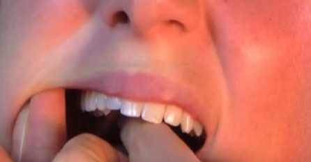 Efikasno rješenje za uklanjanje zubobolje