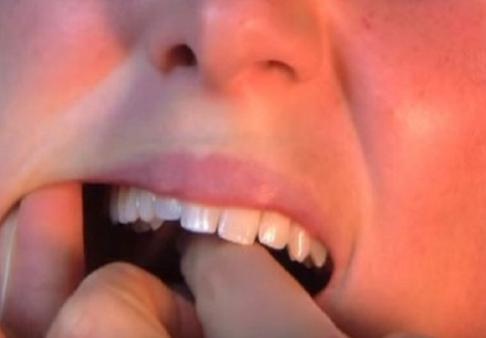 Efikasno rješenje za uklanjanje zubobolje