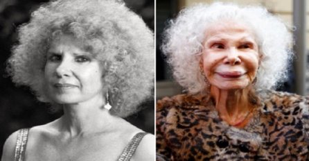 Plastične operacije poznatih koje su pošle naopako: Treća slika će vam zgroziti dan (VIDEO)