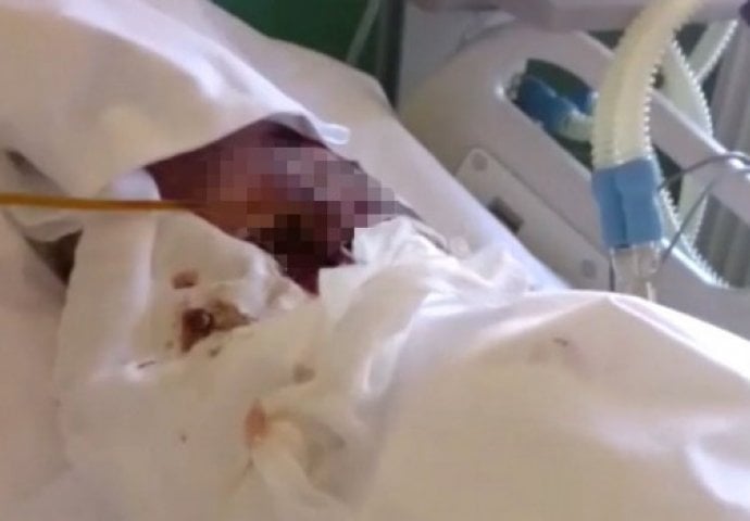 (UZNEMIRUJUĆI VIDEO) Pacijenti u ovoj bolnici su živi pojedini: Niko nije primjetio  ove ubice koje gmižu po njima