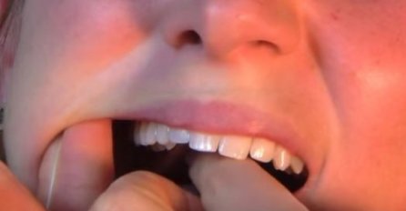 Cijelog života pogrešno koristite konac za zube, evo kako je pravilno! (VIDEO)