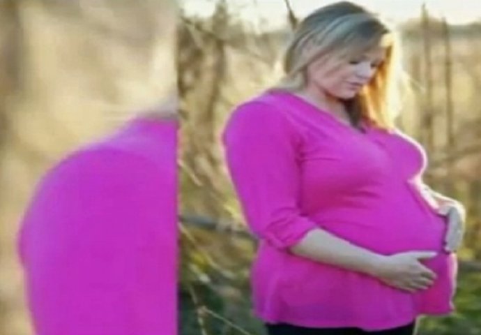 Ova trudnica je umrla tokom porođaja: Ono što se dogodilo u nastavku šokiralo je čak i doktore (VIDEO)