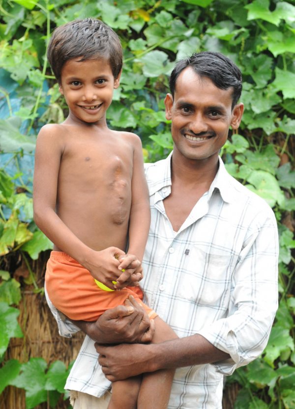 djecak-sa-8-osam-udova-jpg