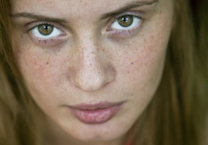 Savjeti za efikasno uklanjanje tamnih fleka sa lica 