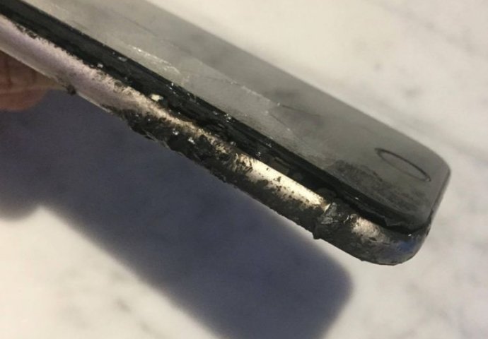 Zaradio teške opekline nakon što mu je eksplodirao  iPhone u džepu