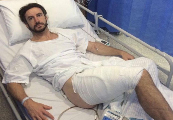 Zaradio teške opekline nakon što mu je eksplodirao  iPhone u džepu