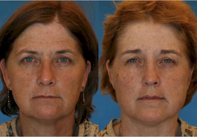 Kad vidite zastrašujuće razlike između blizanaca pušača i nepušača, ODMAH ćete ostaviti cigarete!