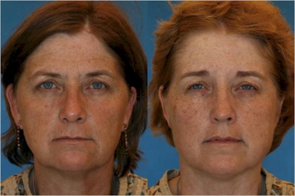 mozete-li-da-pogodite-4