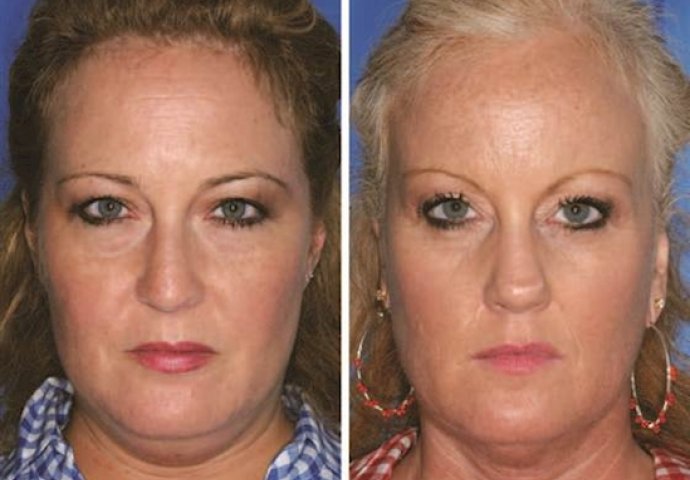 Kad vidite zastrašujuće razlike između blizanaca pušača i nepušača, ODMAH ćete ostaviti cigarete!