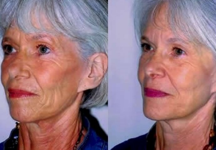 Kad vidite zastrašujuće razlike između blizanaca pušača i nepušača, ODMAH ćete ostaviti cigarete!