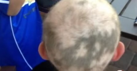 Mama je poslala sina u školu, a onda je učitelj primjetio OVO na njegovoj glavi! (VIDEO) 