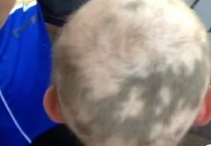 Mama je poslala sina u školu, a onda je učitelj primjetio OVO na njegovoj glavi! (VIDEO) 