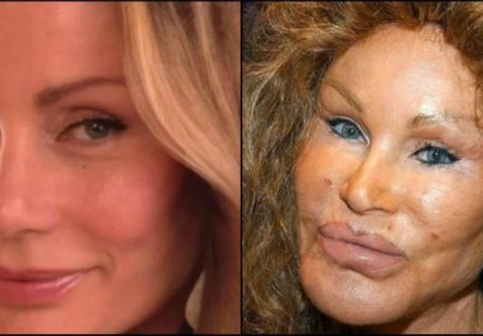 Poznate zvijezde koje su potpuno uništile izgled opijatima, operacijama i drugim porocima