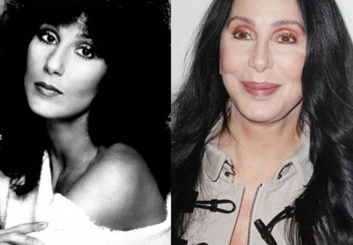 Poznate zvijezde koje su potpuno uništile izgled opijatima, operacijama i drugim porocima