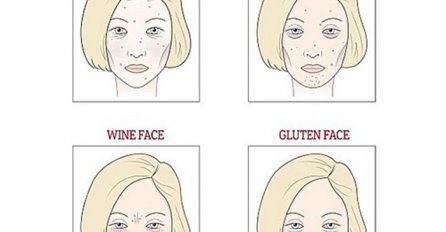 Lice otkriva što vam smeta - šećer, vino, mlijeko ili gluten? 