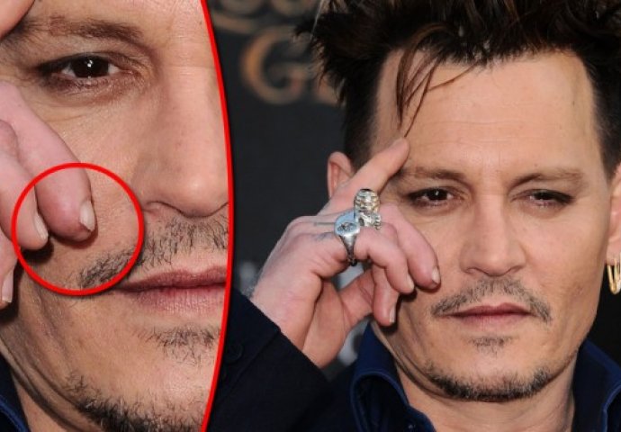 Šokantan potez slavnog glumca: Johnny Depp odsjekao sebi vrh prsta