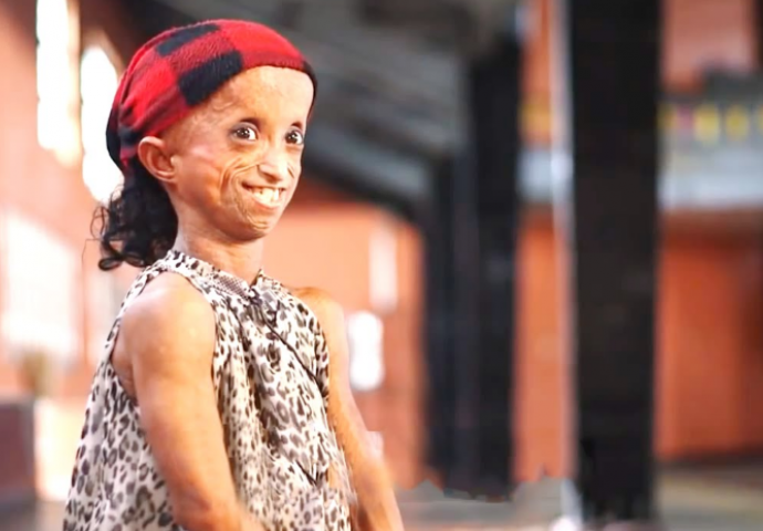 Filipinci oplakuju tinejdžericu koja je izgledala  poput nekoga tko je doživio 136. godinu 