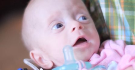 Dirljiva priča koja će vas ostaviti u suzama: Usvojili bebu bez mozga iz nevjerovatnog razloga (VIDEO) 