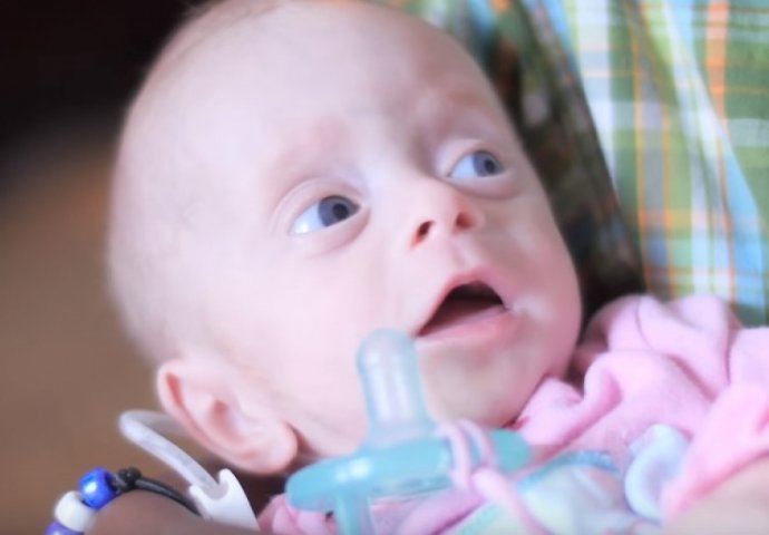 Dirljiva priča koja će vas ostaviti u suzama: Usvojili bebu bez mozga iz nevjerovatnog razloga (VIDEO) 