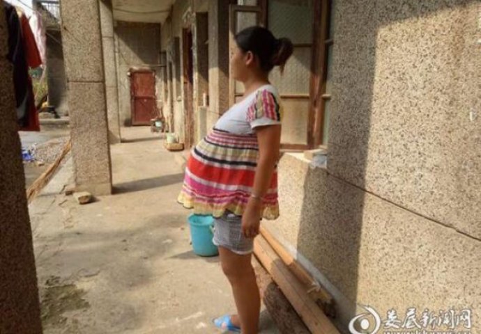 Nezapamćen slučaj: Kineskinja tvrdi da je trudna čak 17 mjeseci