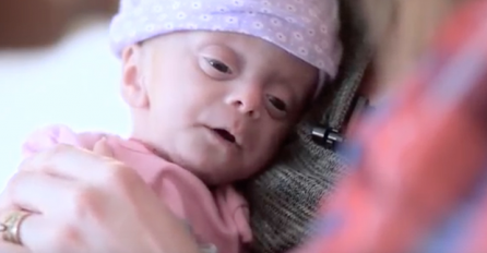 Udomili su blizance, ali za jednu bebu su saznali da nema mozga, razlog zašto su je zadržali je nevjerovatan