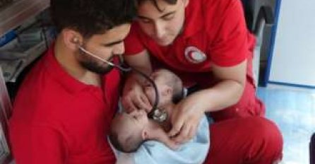 Preminuli jednomjesečni sijamski blizanci rođeni u Siriji