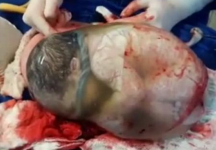 ZADIVLJUJUĆE: Video bebe rođene u netaknutom vodenjaku ostavit će vas bez riječi 