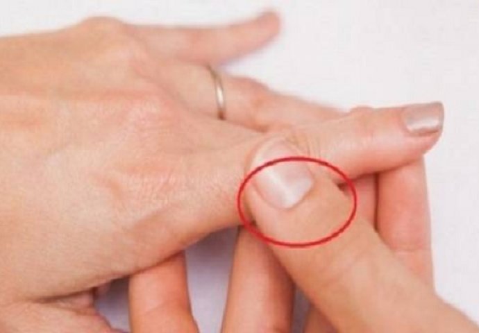 VAŽNIJE NEGO ŠTO MISLITE: Znate li šta znači polumjesec na vašim noktima?