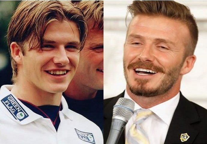 Može li se novcem kupiti ljepota? Ovi poznati su uspjeli u tome (FOTO)