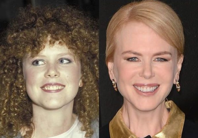 Može li se novcem kupiti ljepota? Ovi poznati su uspjeli u tome (FOTO)