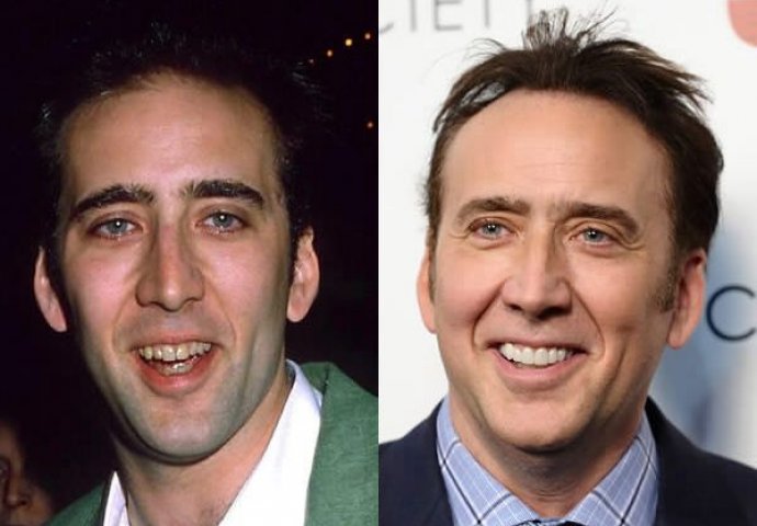 Može li se novcem kupiti ljepota? Ovi poznati su uspjeli u tome (FOTO)