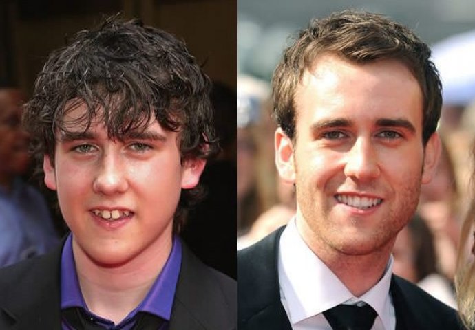 Može li se novcem kupiti ljepota? Ovi poznati su uspjeli u tome (FOTO)