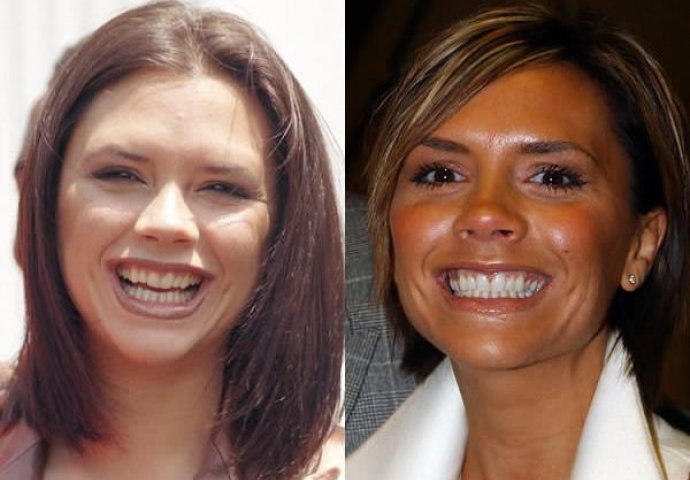 Može li se novcem kupiti ljepota? Ovi poznati su uspjeli u tome (FOTO)