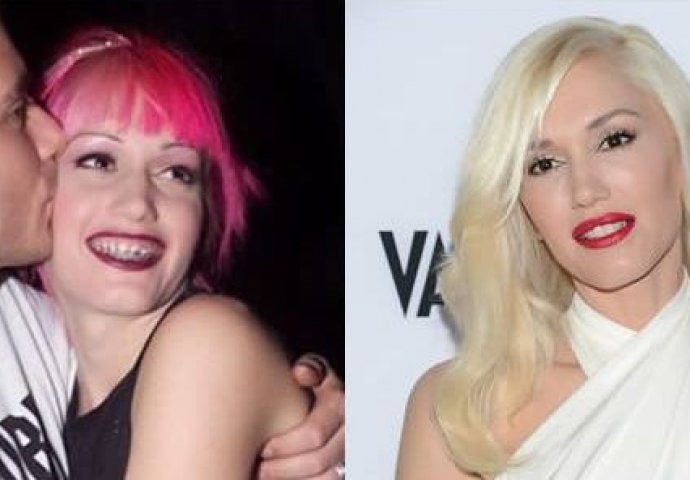 Može li se novcem kupiti ljepota? Ovi poznati su uspjeli u tome (FOTO)